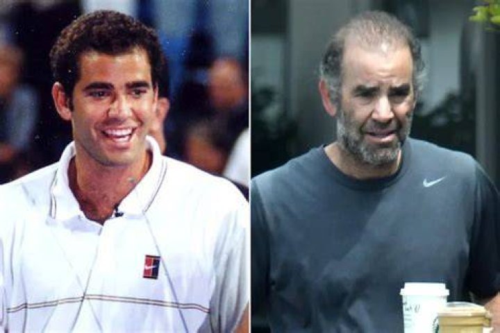 30 Years Ago Pete Sampras rises to No. 1 on the ATP rankings for the