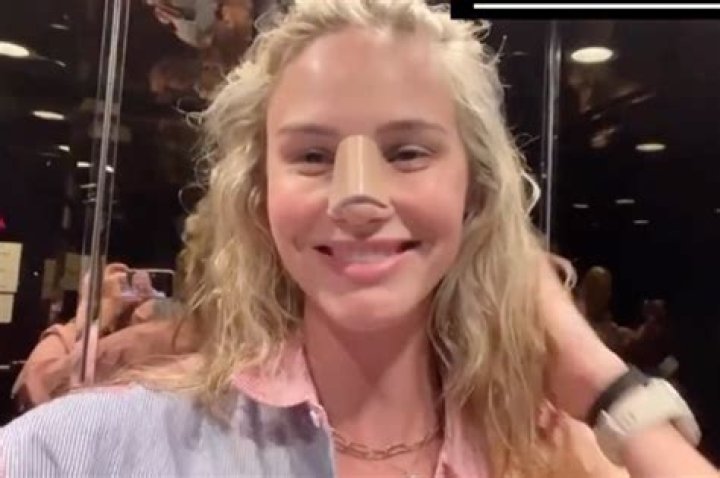 Amilie maurismo boob job