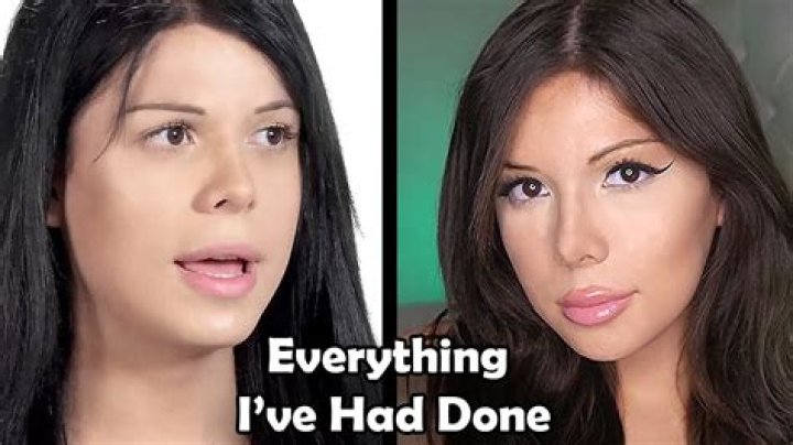 Blaire White Before and After Transformations Trans YouTuber