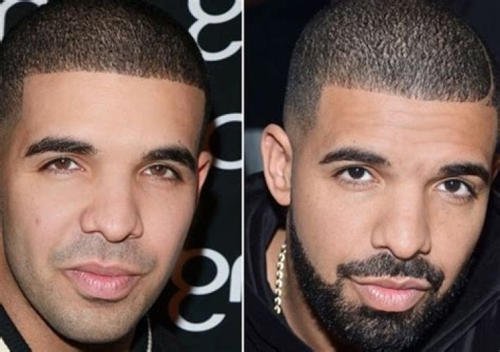 Did Drake Get A Nose Job?! Rick Ross Says So! Perez Hilton