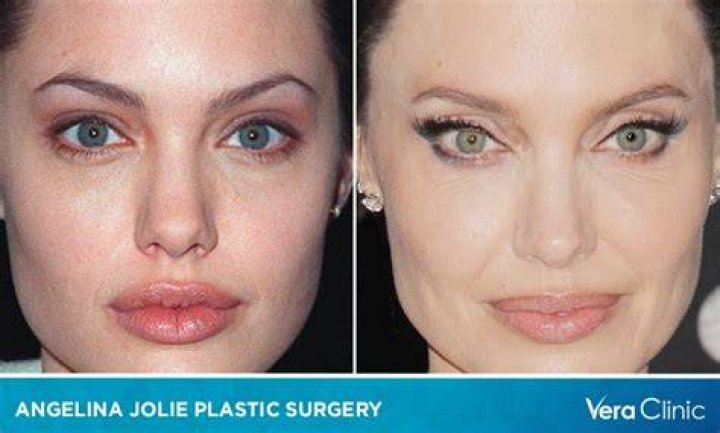 Did she get plastic surgery? GirlsAskGuys