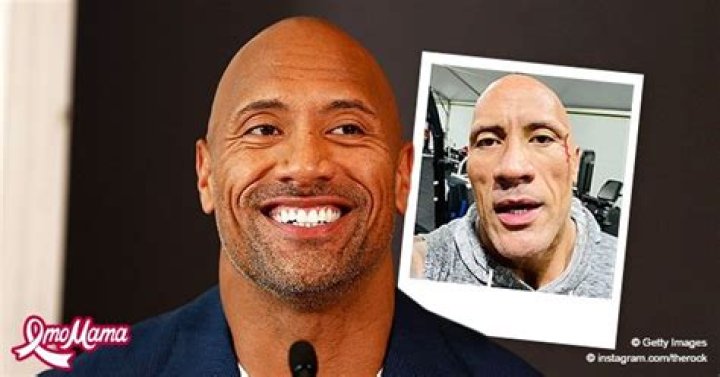 Dwayne Johnson Suffers Minor Face Injury during Intense Workout &mdash; Here