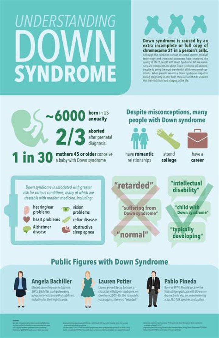 Facts about Down Syndrome CDC (2022)