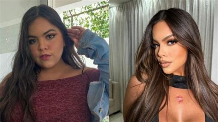 Gracie Bon Before And After Plastic Surgery Who Was Her Surgeon