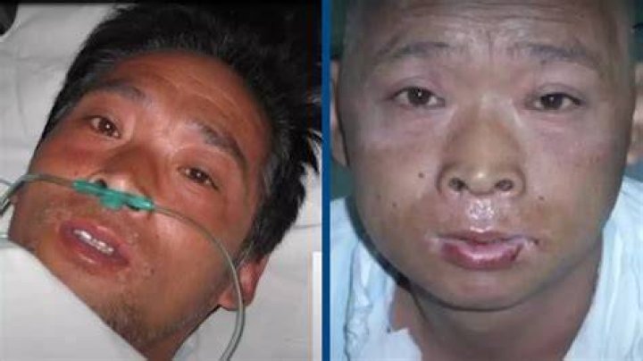 Hisashi Ouchi The Technician Tormented By Radiation Of Tokaimura
