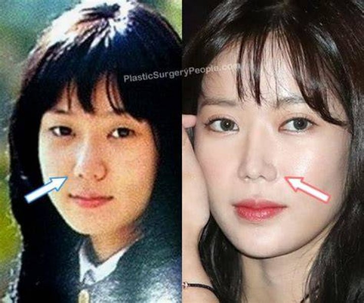 Im Soo Hyang Plastic Surgery The Truth Behind Her Changing Looks