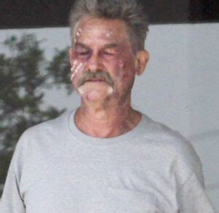 Is Kurt Russell Sick? Battle With PJS And Its Treatment Health Updates