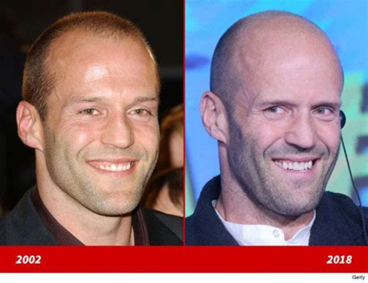 Jason Statham Before And After