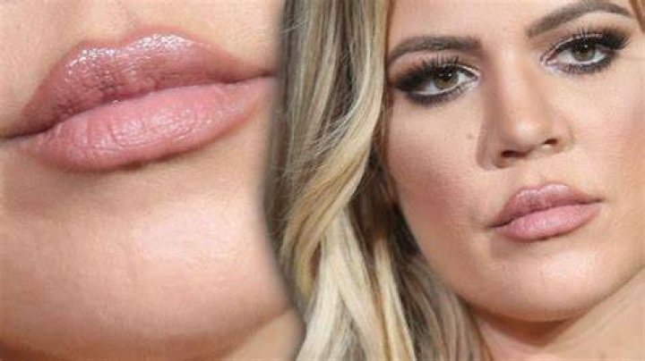 Khloe Kardashian reveals &lsquo;destroyed&rsquo; lips while trying to &lsquo;hide&rsquo; behind