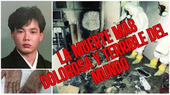 La agon&iacute;a de Hisashi Ouchi, el hombre que sufri&oacute; la mayor carga