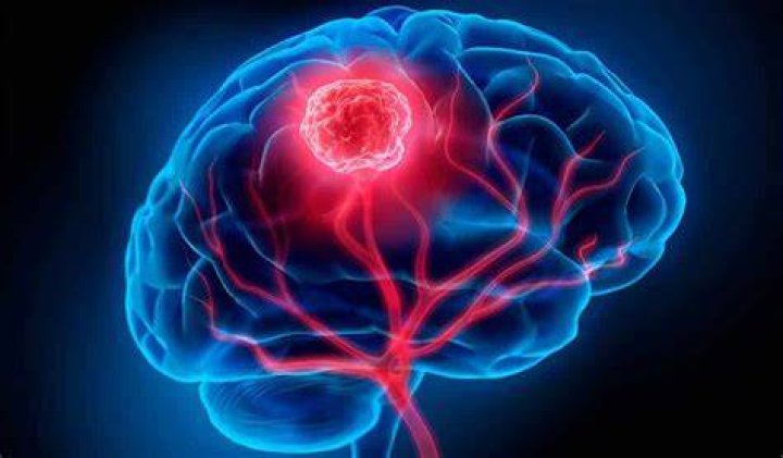 Le detectan tumor en la cabeza a Paty Navidad