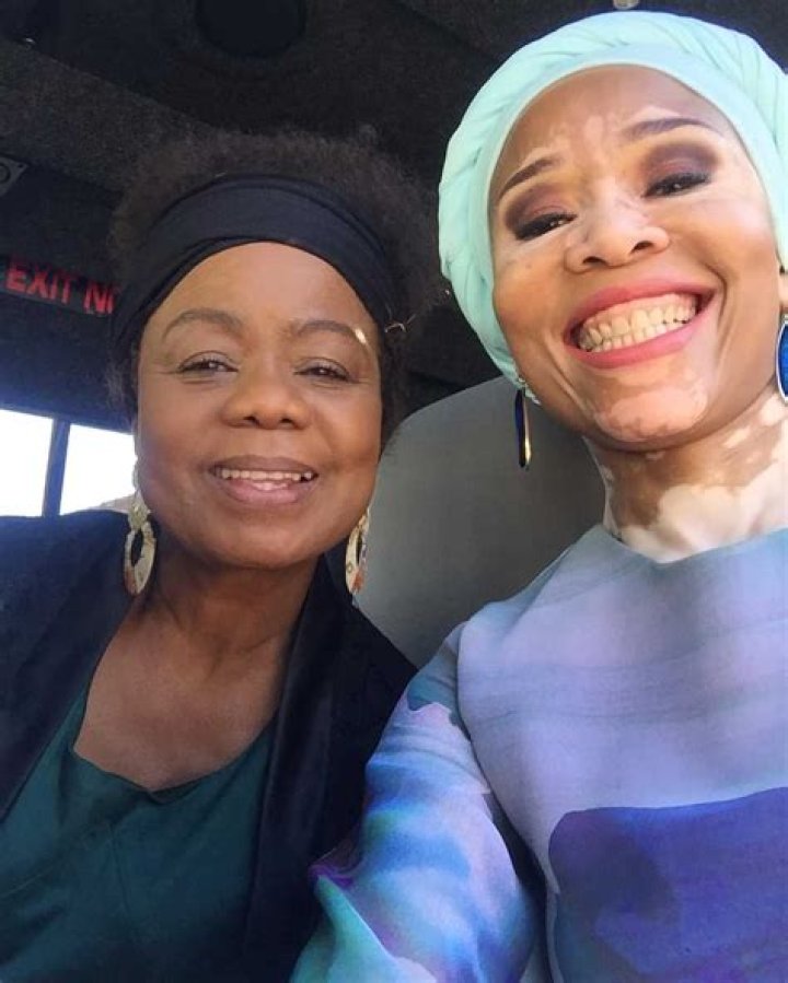 Leleti Khumalo biography age, skin condition, twins, husband, and