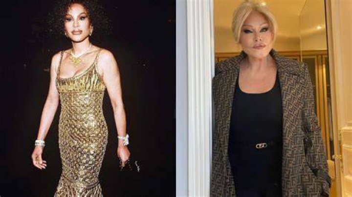 Lion Lady Plastic Surgery An American Socialite Disputes Having