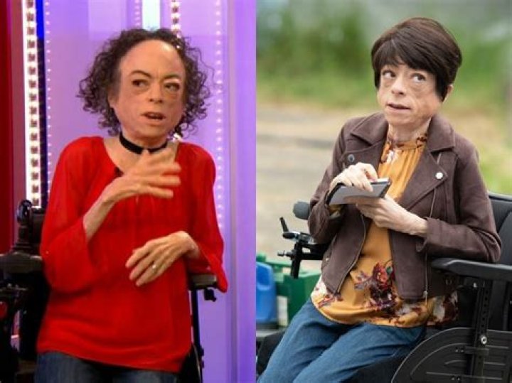 Liz Carr Biography, Age, Height, Husband, Net Worth StarsWiki