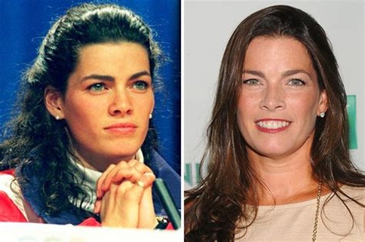 Nancy Kerrigan Then And Now