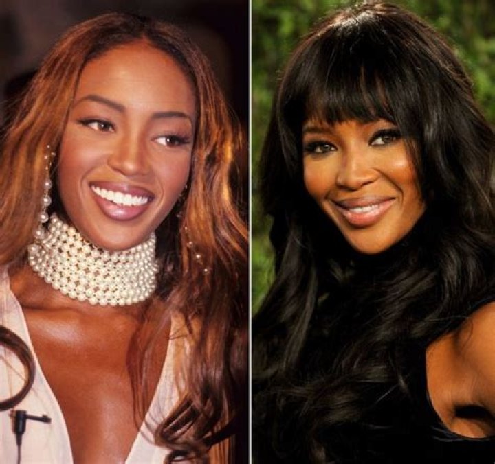 Naomi Campbell Plastic Surgery Before and After Photo Nose Job
