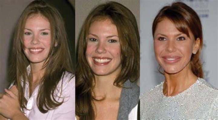 Nikki Cox Plastic Surgery How A Wrong Surgery Could Obliterate Your Looks