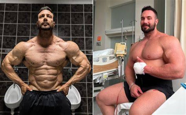 Noel Deyzel Shares Promising Update After Recovering from Stomach