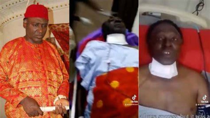 Popular Nollywood actor, Clem Ohameze survives fatal spinal cord surgery