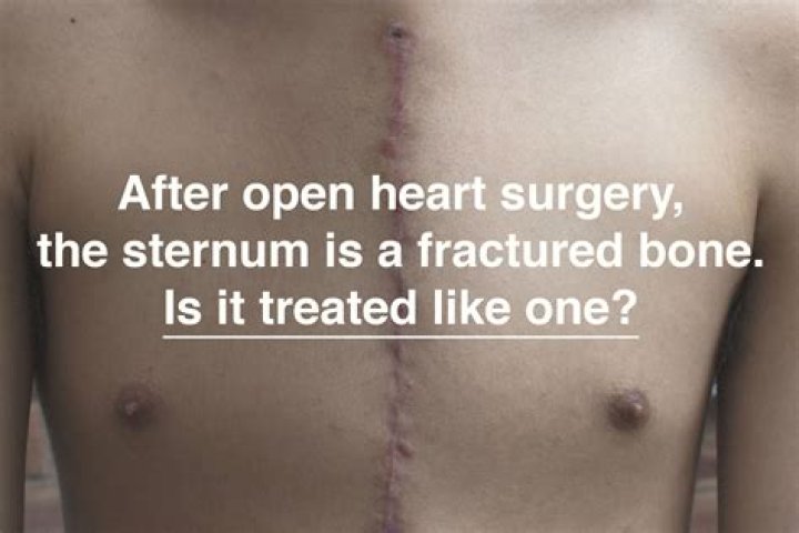 Some Scar from open heart surgery in studio &mdash; Stock Photo &copy; Lopolo