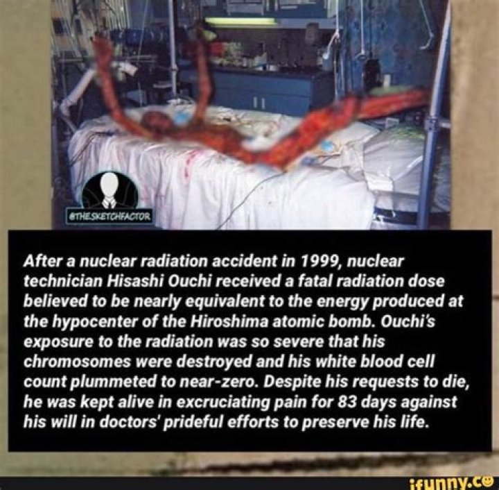 The Aftermath Of Radiation Hisashi Ouchi's Devastating Journey