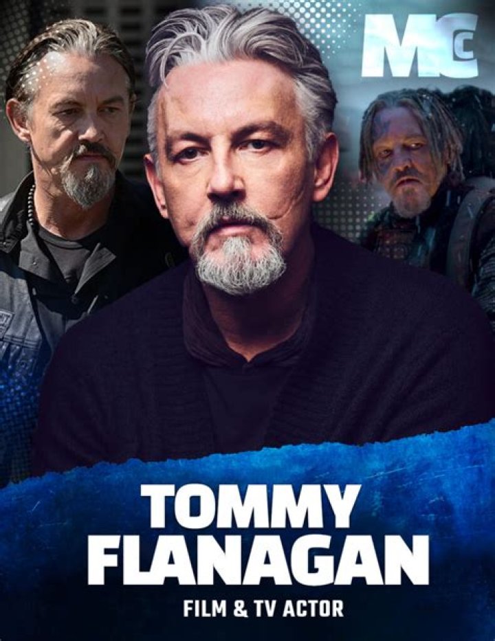 Tommy Flanagan Most Recognised ScarGlaswegian Smile; Proud Of Struggle