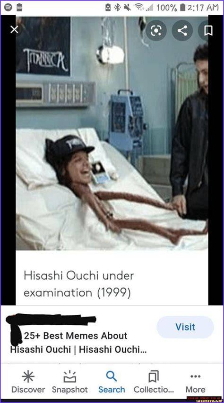 Unveiling The Mystery Hisashi Ouchi Body Photos And The Story Behind Them
