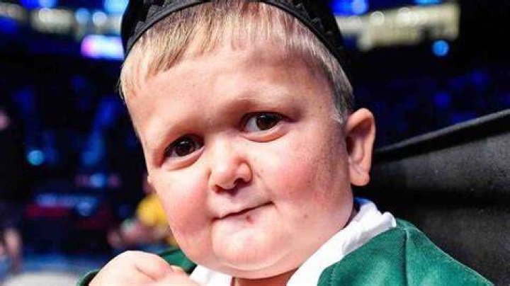 What Disease Does Hasbulla Have? Understanding His Unique Condition