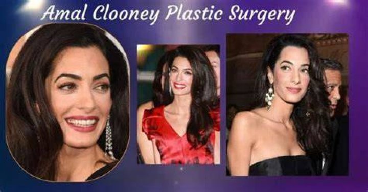 What Plastic Surgery Has Amal Clooney Gotten? Body Measurements and