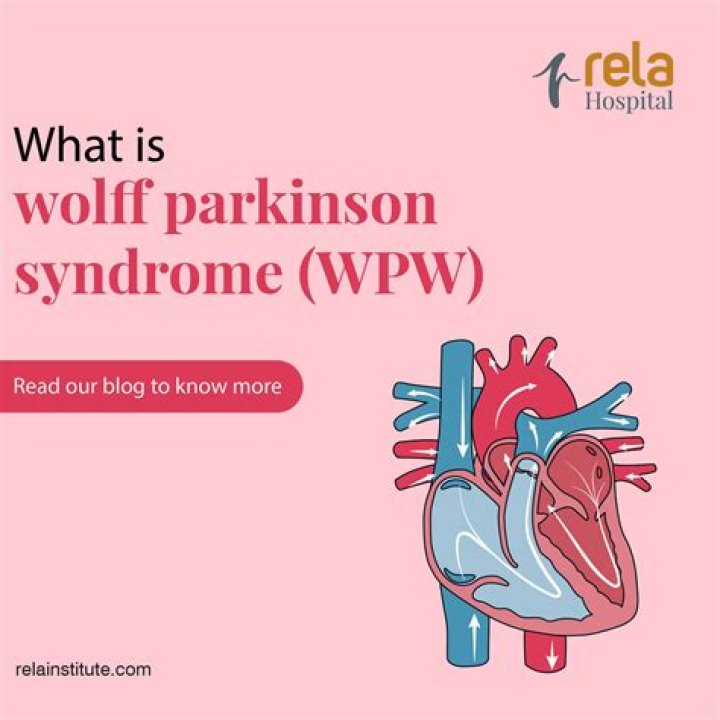 WolffParkinsonWhite syndrome Causes, symptoms, and treatment