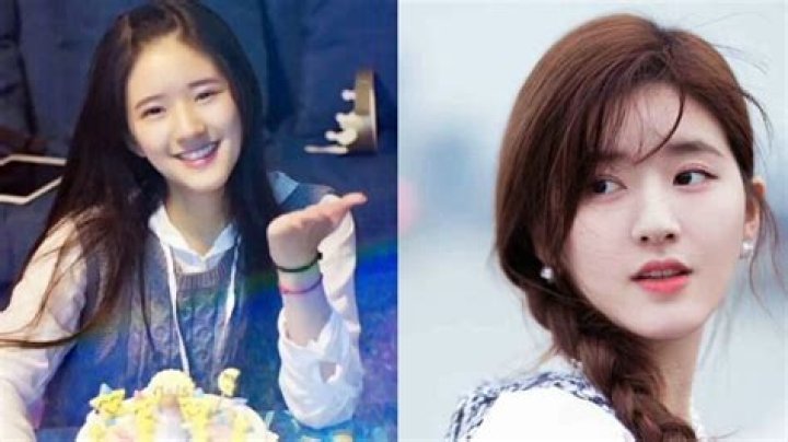 Zhao Lusi Plastic Surgery What Alterations Has She Made? Celeb
